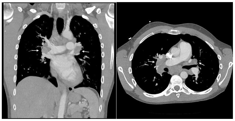 biomedres-openaccess-journal-bjstr