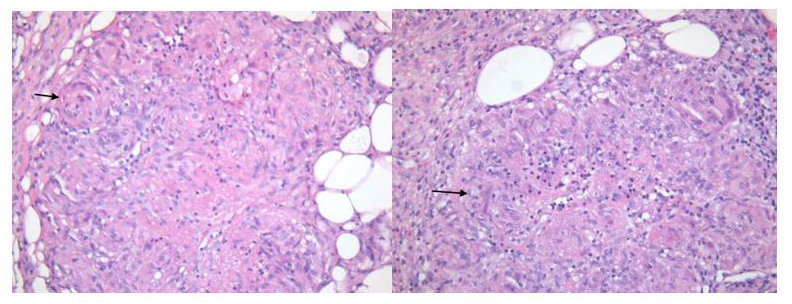 biomedres-openaccess-journal-bjstr