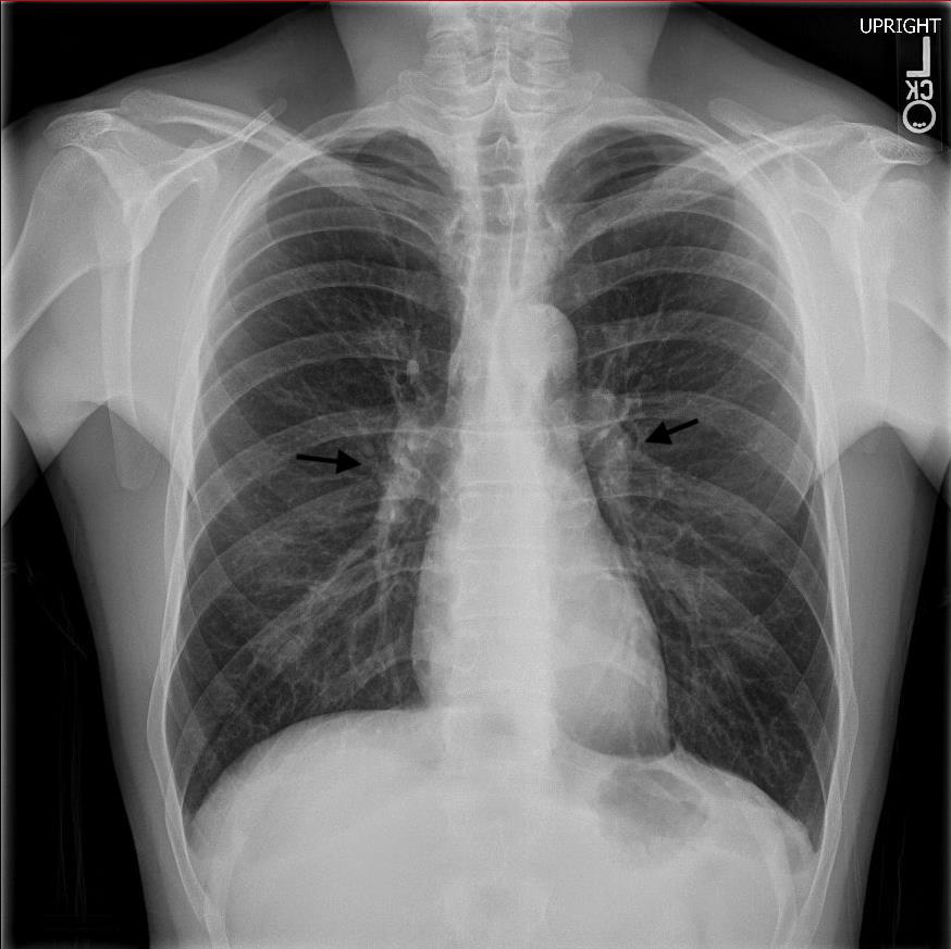 biomedres-openaccess-journal-bjstr
