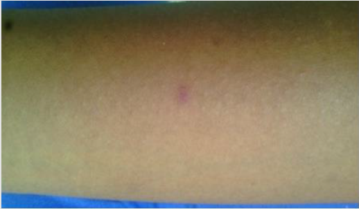 biomedres-openaccess-journal-bjstr