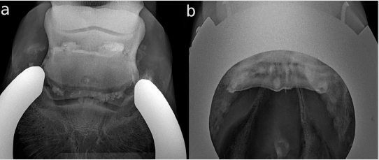 biomedres-openaccess-journal-bjstr