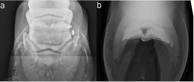 biomedres-openaccess-journal-bjstr