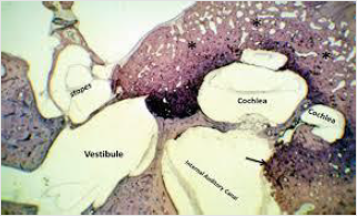 biomedres-openaccess-journal-bjstr