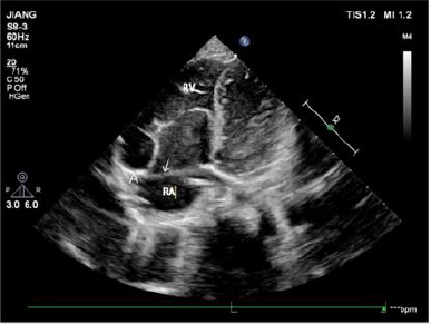biomedres-openaccess-journal-bjstr