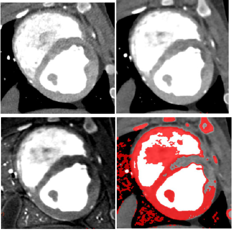 biomedres-openaccess-journal-bjstr